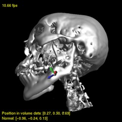 Snapping to isosurfaces